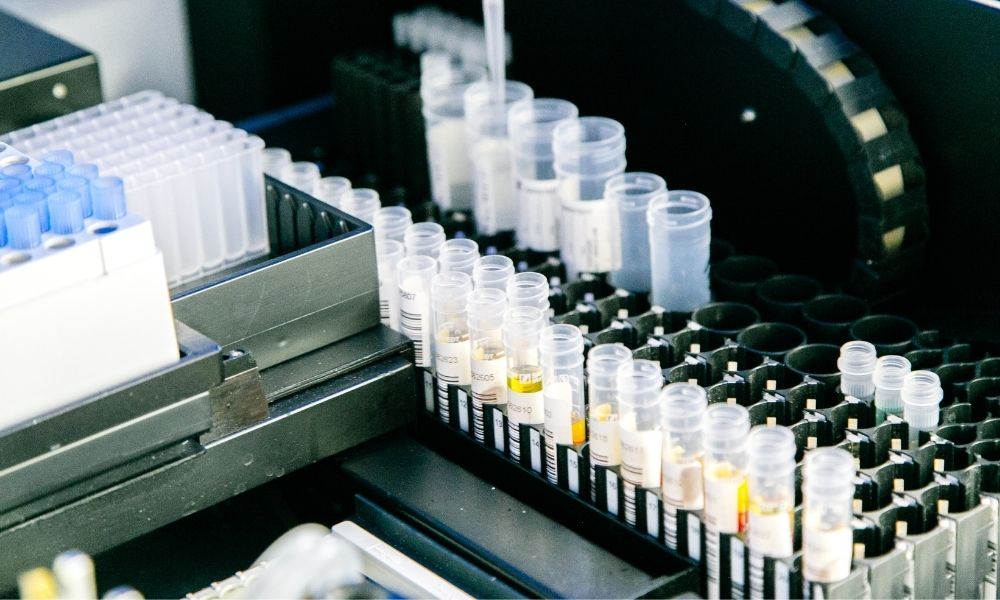 A laboratory setup with multiple small test tubes arranged in racks, some containing liquids of different colors. The test tubes are organized in black trays, with a background of additional lab equipment.