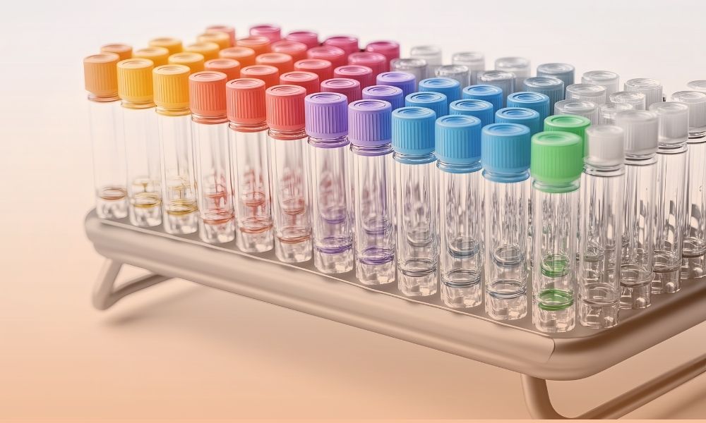Alt text: A close-up view of a rack of transparent test tubes with colorful caps in shades of orange, pink, purple, blue, green, and white, arranged in neat rows on a white stand.